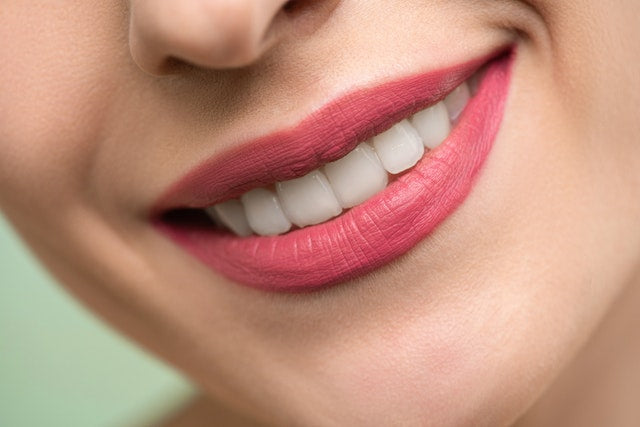 Teeth whitening result